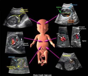 سونوگرافی داپلر بارداری چیست؟