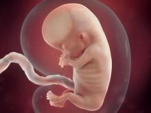 عکس جنین در هفته دهم بارداری