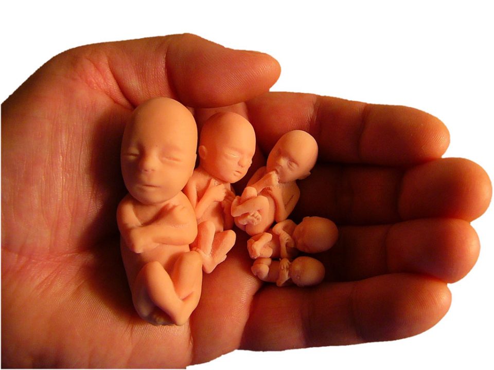 عکس جنین در بارداری