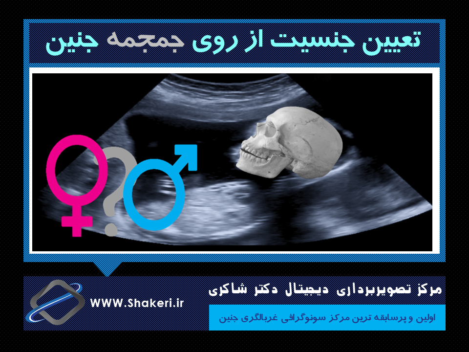 تعیین جنسیت از روی جمجمه جنین