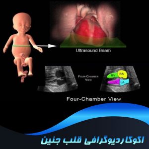 اکوکاردیوگرافی قلب جنین