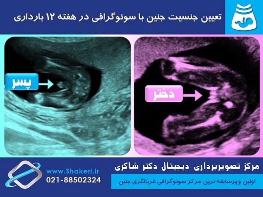 تعیین جنسیت جنین با سونوگرافی در هفته 12 بارداری